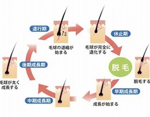 抜け毛の原因と対処法