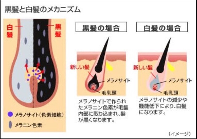 白髪の対策